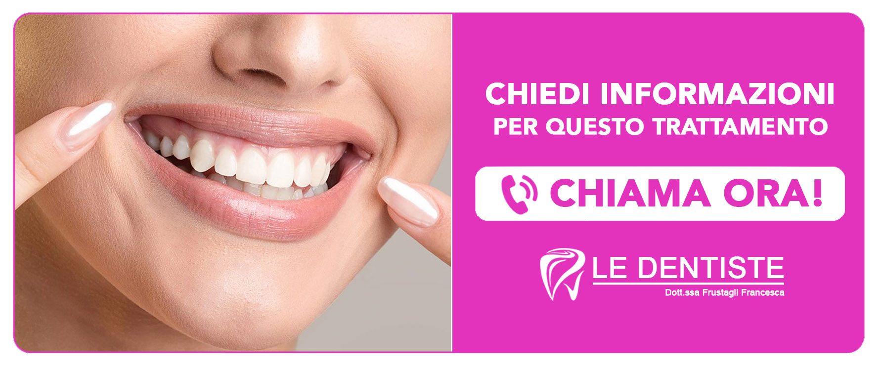 cura-del-gummy-smile-sorriso-gengivale Cisliano (Milano)