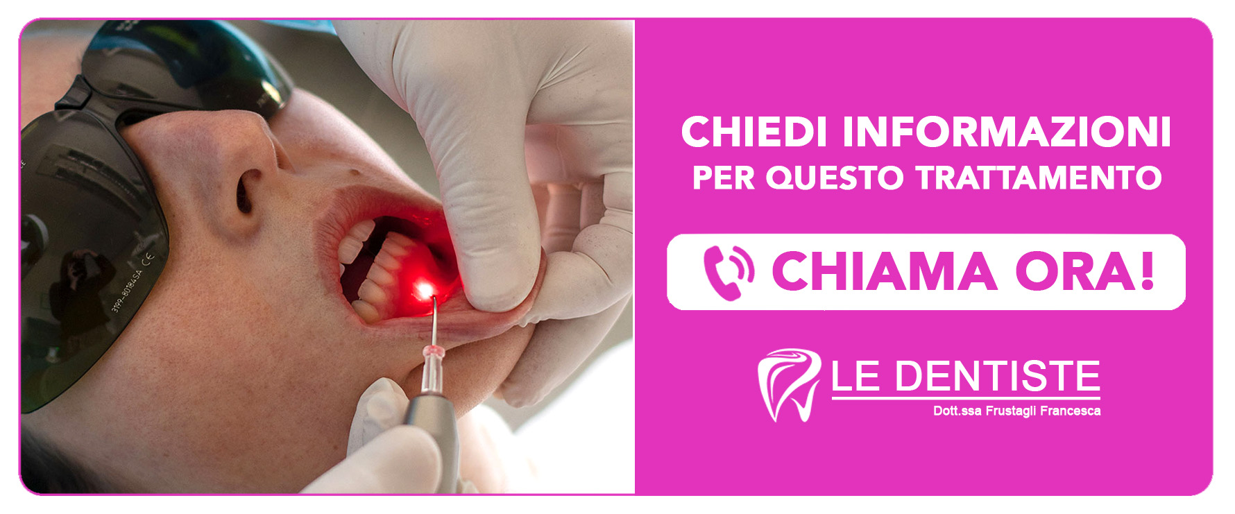 cura-della-parodontite-laser Cisliano (Milano)