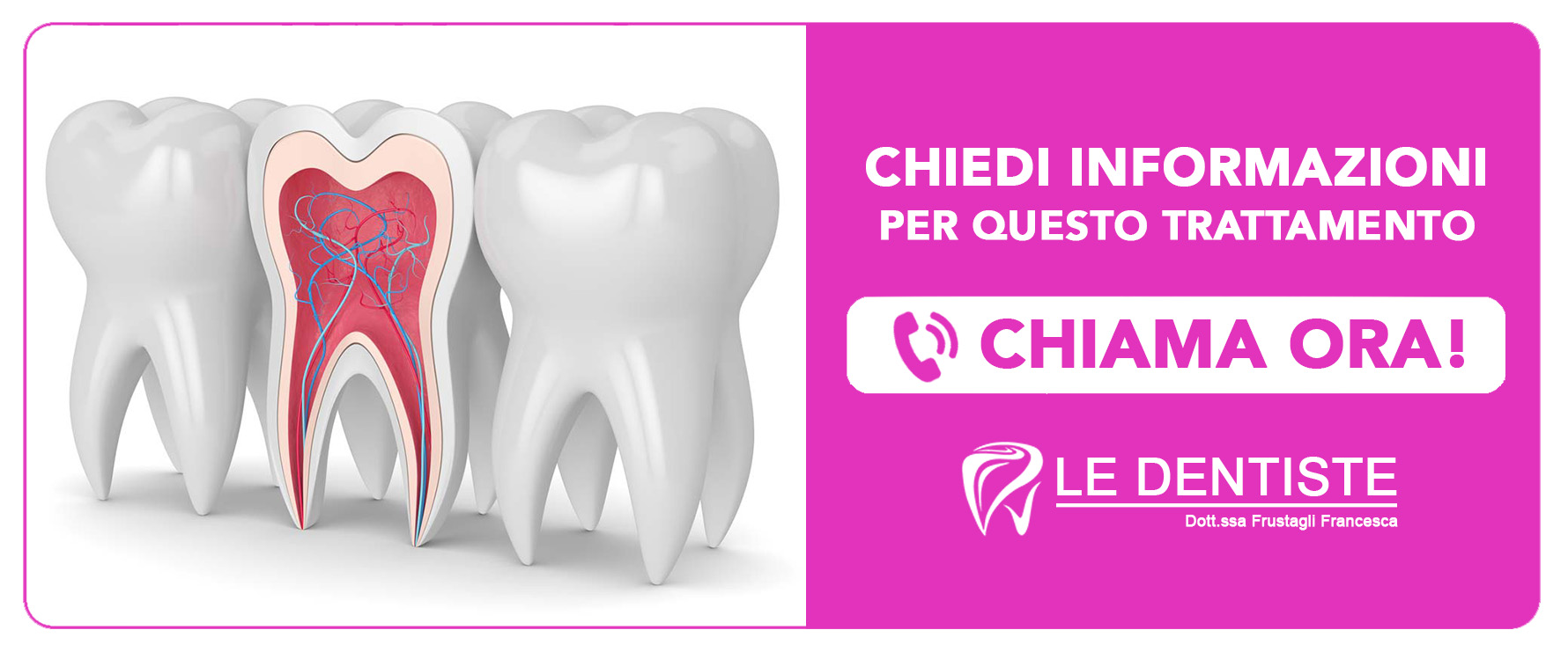 endodonzia Cisliano (Milano)