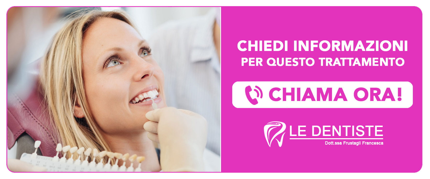 faccette-estetiche-dentali Cisliano (Milano)