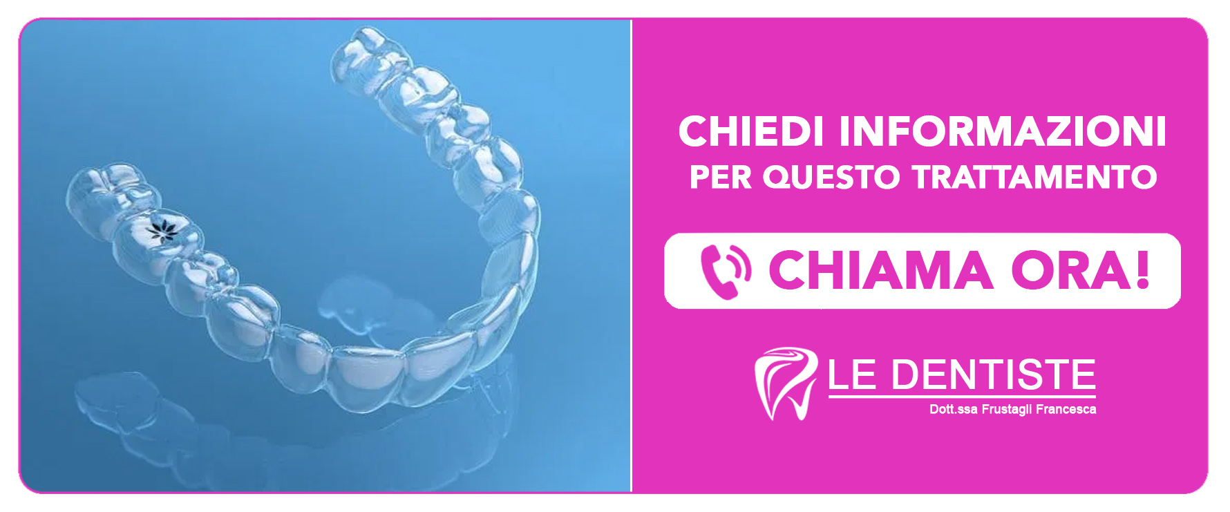 ortodonzia-invisalign Cisliano (Milano)