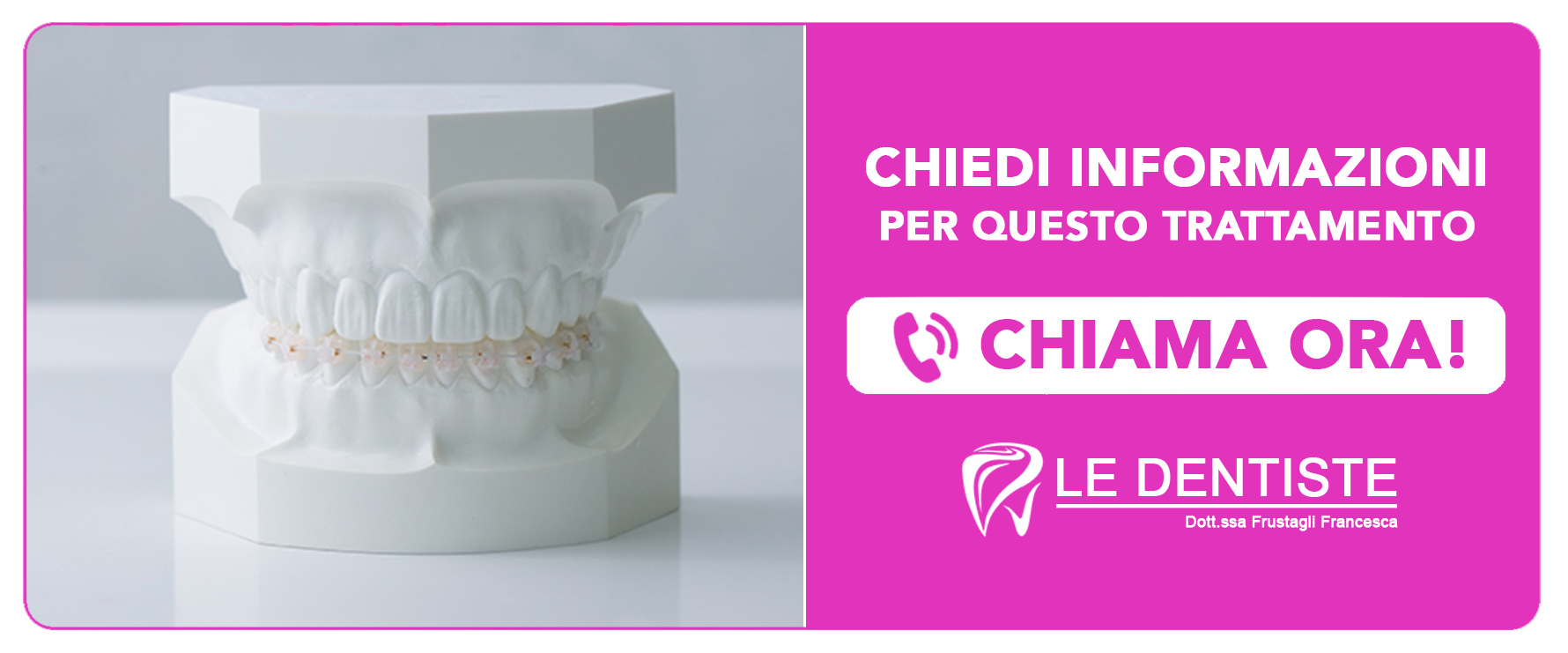 ortodonzia-prechirurgica Cisliano (Milano)